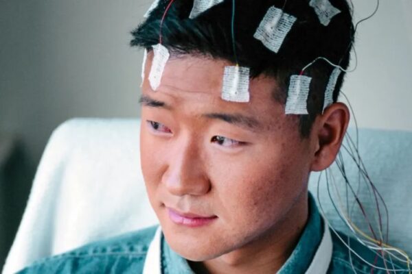 Exploring Epilepsy: Symptoms, Causes, and Treatment Options Epilepsy